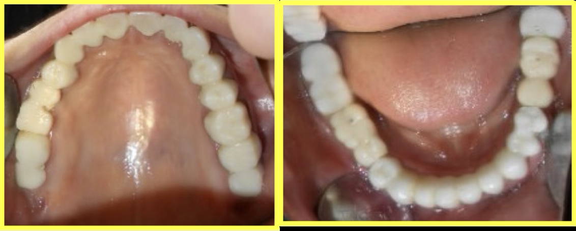 Initial Consultation and Diagnosis