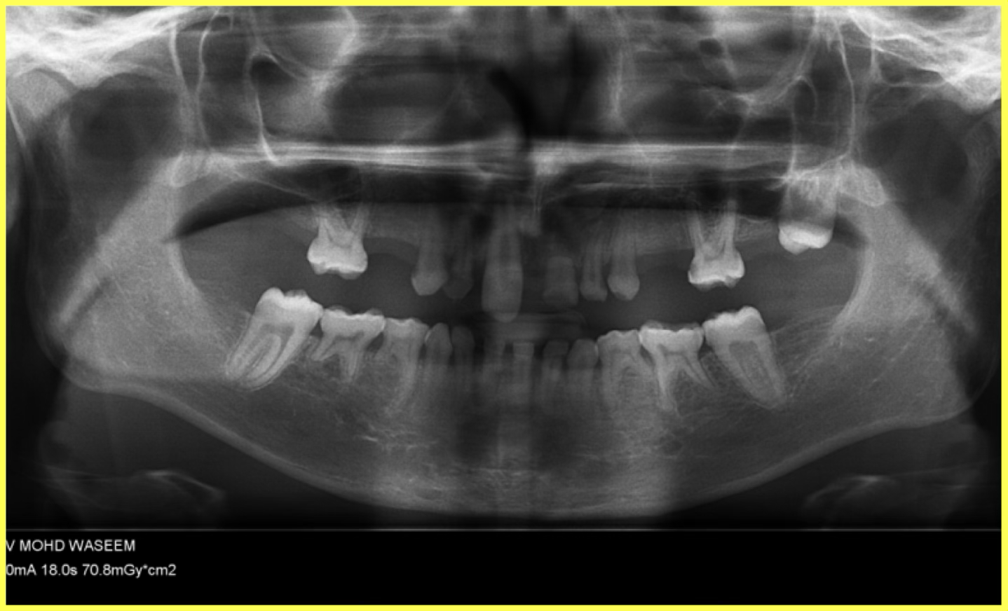 Initial Consultation and Diagnosis