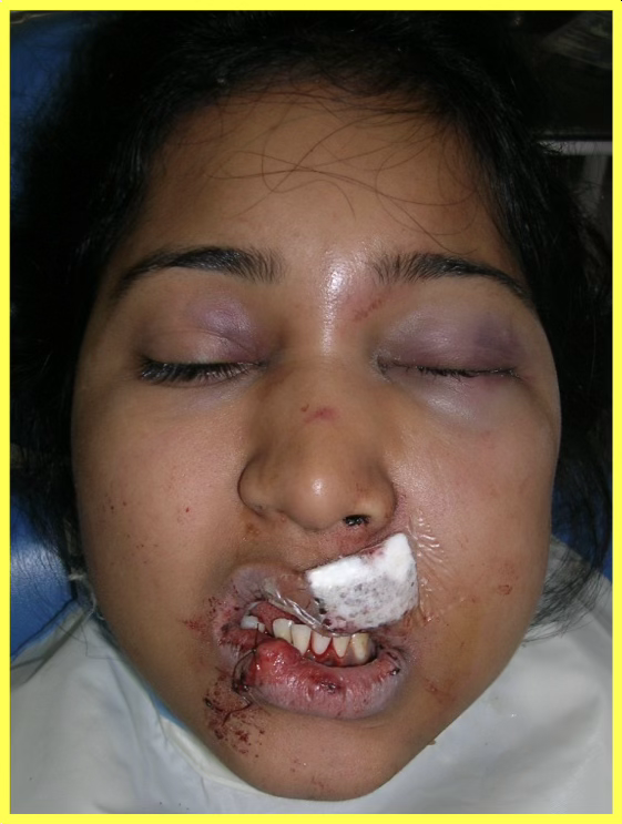 Post-Surgery Assessment