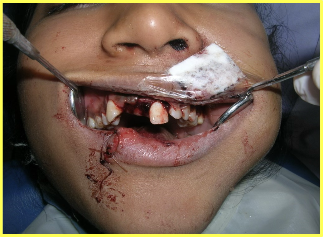 Emergency Consultation and Initial Management